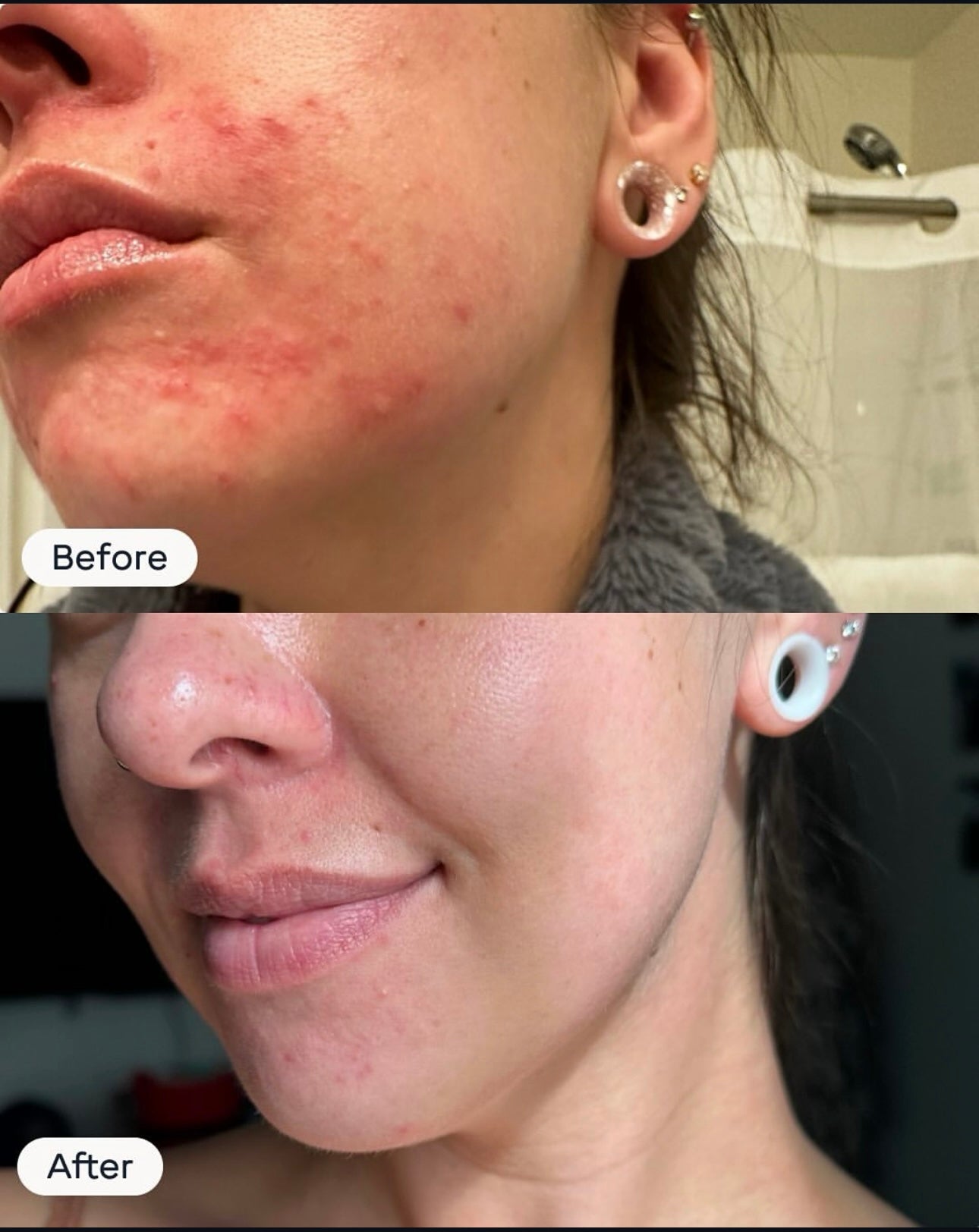 ácido hipocloroso- 3.4 oz magic molecule