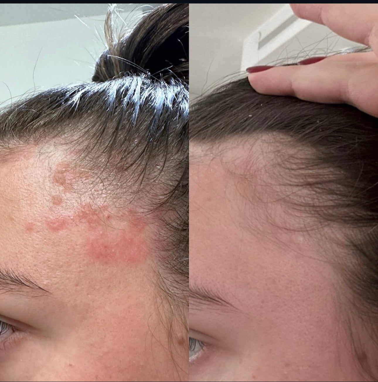 ácido hipocloroso- 3.4 oz magic molecule