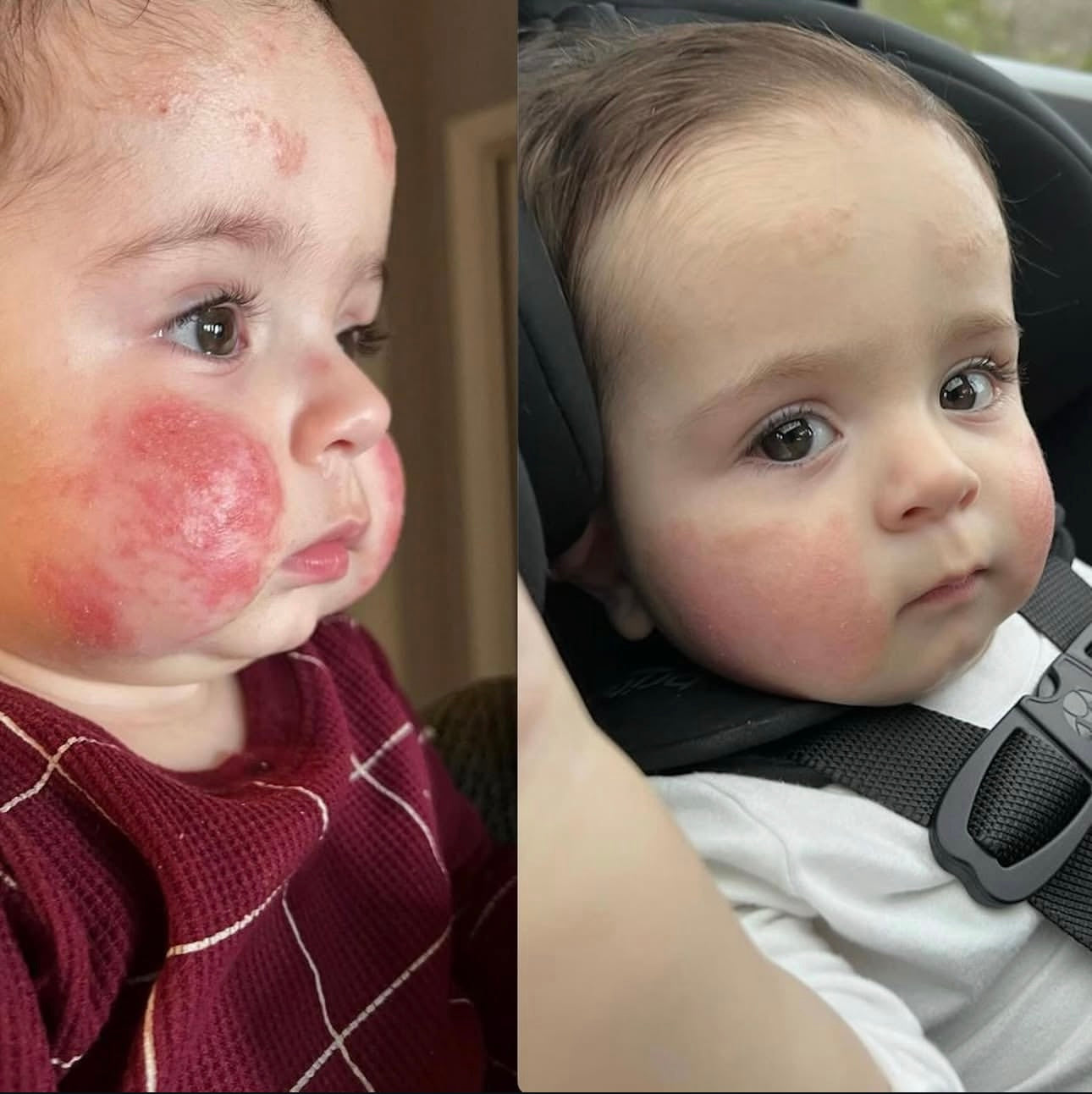 ácido hipocloroso- 3.4 oz magic molecule